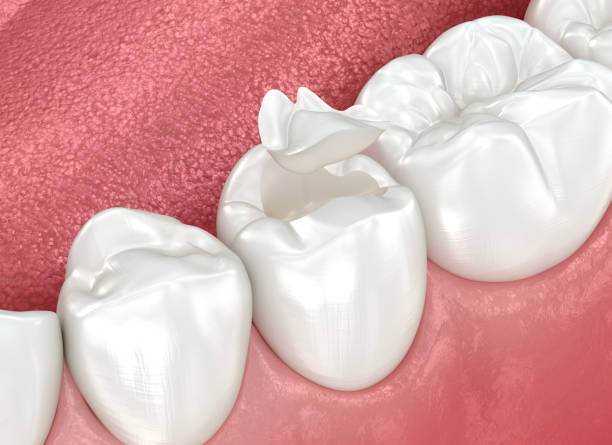 Our Range of Dental Services in Fostoria, OH